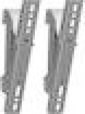 Vogels Vogels Pfs 3302, 1,5 Kg, 4,1 Cm, 5,2 Cm, Negro Vogels Vogels Pfs 3302, 1,5 Kg, 4,1 Cm, 5,2 Cm, Negro