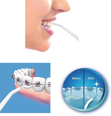 AGD Irrigador Bucal Con Sistema de Propulsión. AGD Irrigador Bucal Con Sistema de Propulsión.