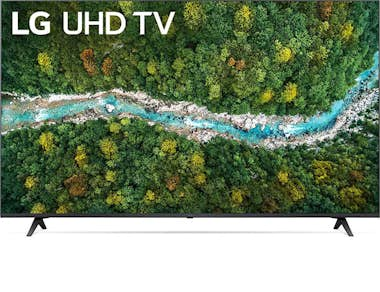 LG 65UP77003LB Televisor 65"" LED UHD 4K 60 Hz Smart